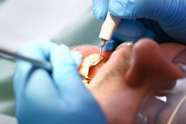 Best Emergency Treatment for Toothache in Croydon, PA